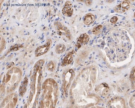 HUABIO HA722570 image 2