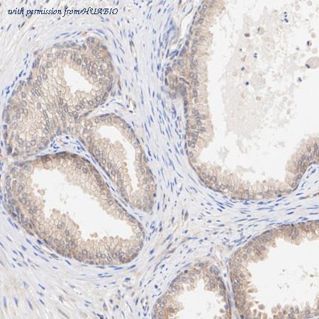 HUABIO HA722658 image 3