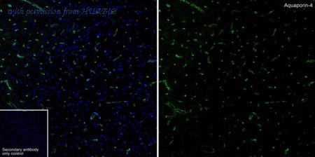 HUABIO HA722672 image 1