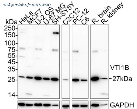 HUABIO HA722675 image 1