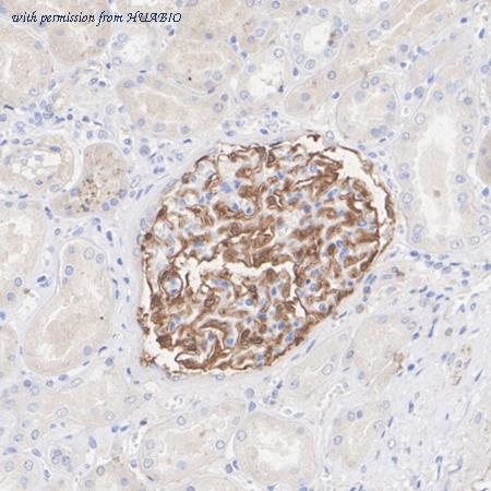 HUABIO HA722695 image 3