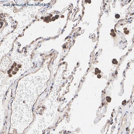 HUABIO HA722712 image 2