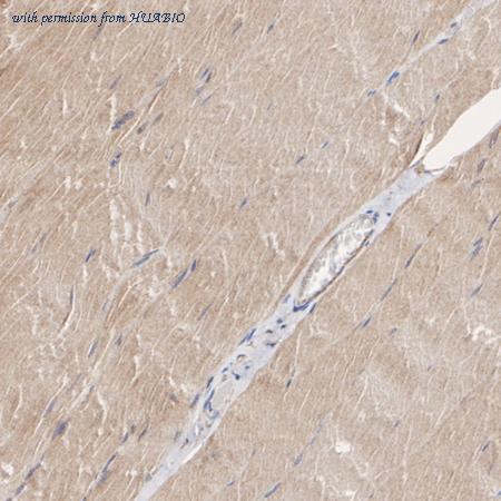 HUABIO HA722717 image 3