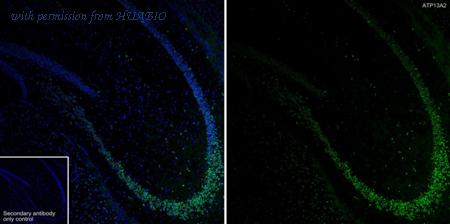 HUABIO HA722741 image 1