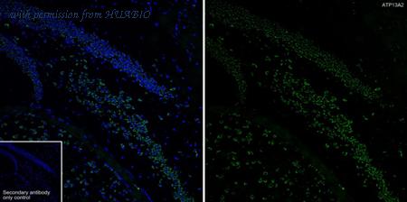 HUABIO HA722741 image 2