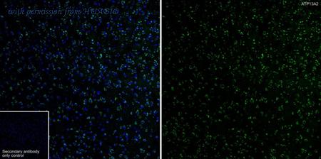 HUABIO HA722741 image 3