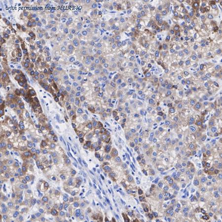 HUABIO HA722749 image 2