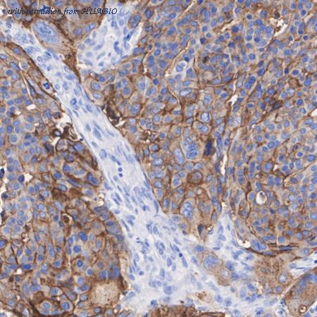 HUABIO HA722768 image 2