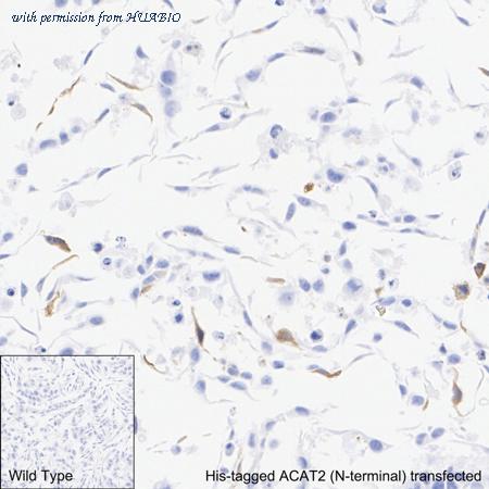 HUABIO HA722798 image 3