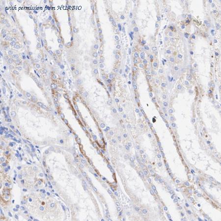 HUABIO HA722811 image 2