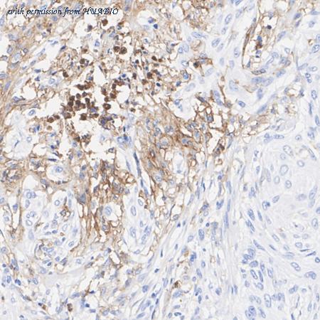 HUABIO HA722856 image 2