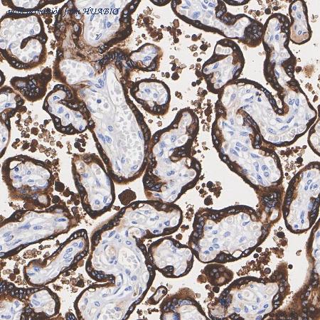 HUABIO HA722865 image 1