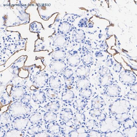 HUABIO HA722867 image 2