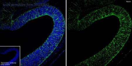 HUABIO HA722919 image 3