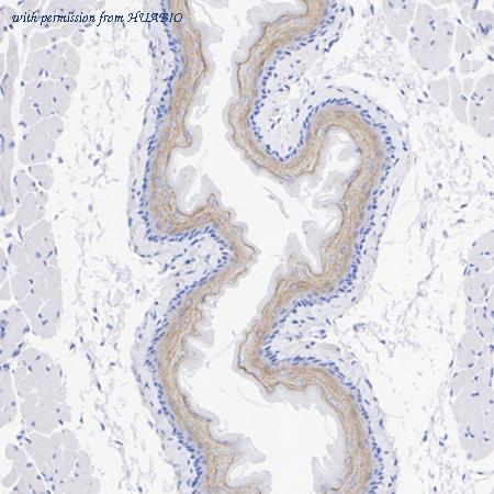 HUABIO HA722930 image 3