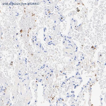 HUABIO HA722940 image 2