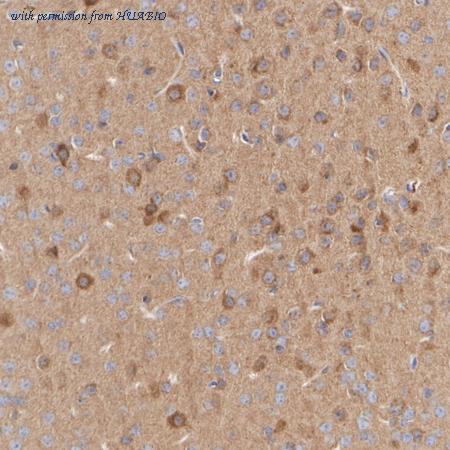 HUABIO HA723020 image 3