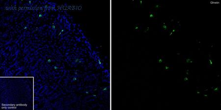 HUABIO HA723029 image 1