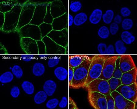 HUABIO HA723252 image 1