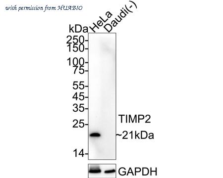 HUABIO HA723358 image 1
