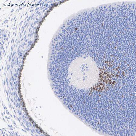 HUABIO HA723361 image 3