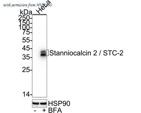HUABIO HA723414 image 2