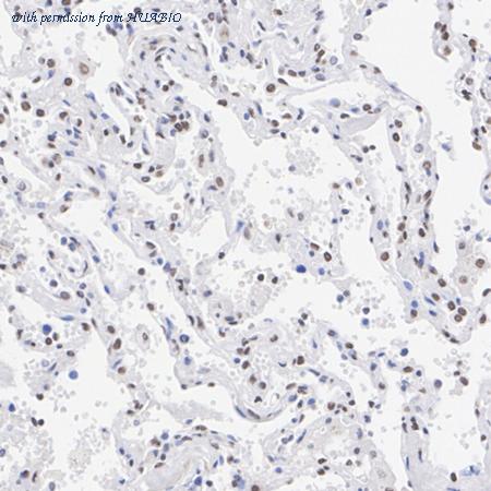 HUABIO HA723602 image 3