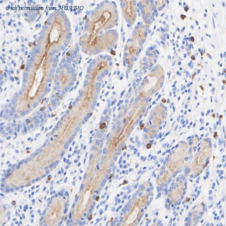 HUABIO HA723666 image 3