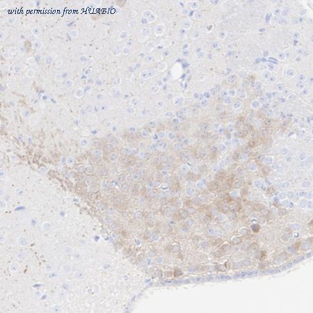 HUABIO HA723755 image 1