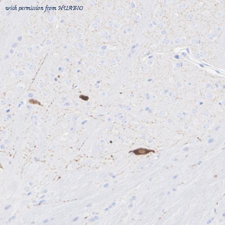 HUABIO HA723755 image 2