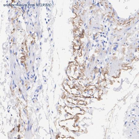 HUABIO HA723818 image 1