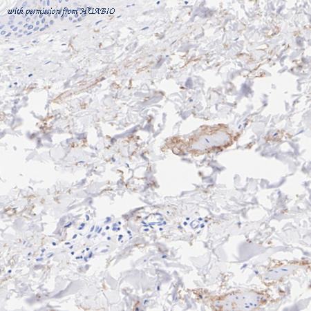 HUABIO HA723818 image 3