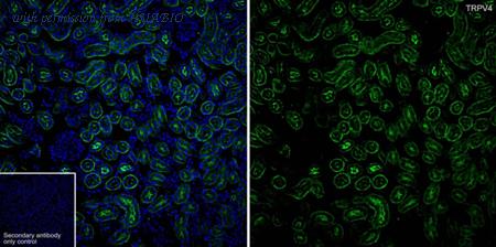 HUABIO HA723855 image 2