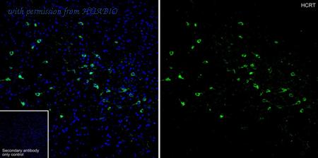 HUABIO HA723879 image 1