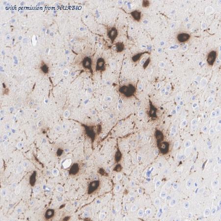 HUABIO HA723879 image 2