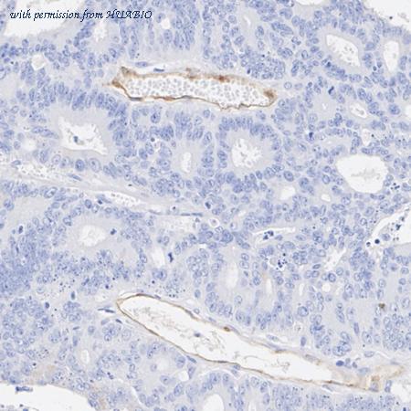 HUABIO HA723892 image 3