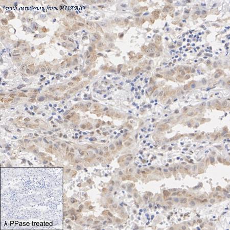 HUABIO HA723960 image 2