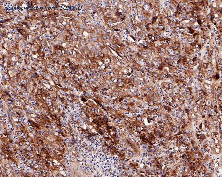 HUABIO HA750008 image 3