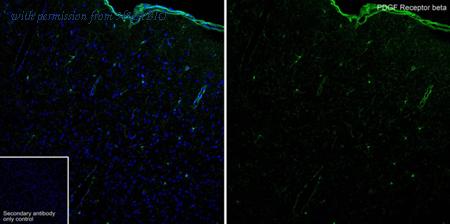 HUABIO HA750082 image 1