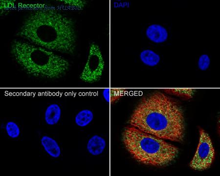 HUABIO HA750107 image 3