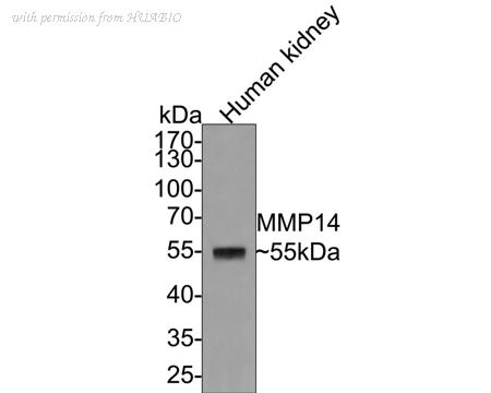 HUABIO HA750108 image 1