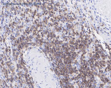 HUABIO HA750115 image 3