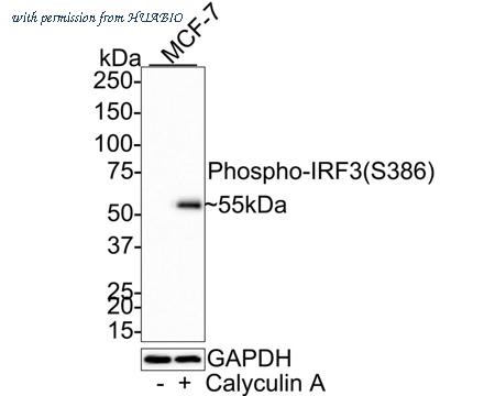 HUABIO HA750138 image 1