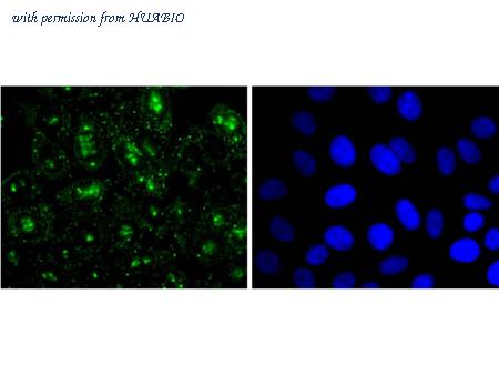 HUABIO HA750197 image 1