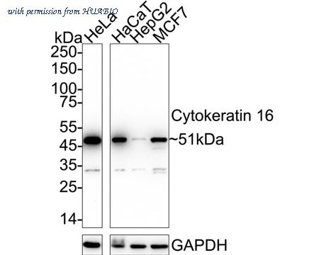 HUABIO HA750203 image 1