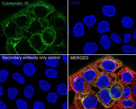 HUABIO HA750203 image 2