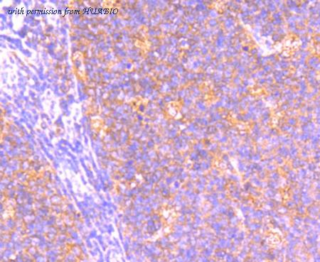 HUABIO HA750205 image 2