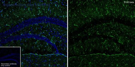 HUABIO HA750209 image 1