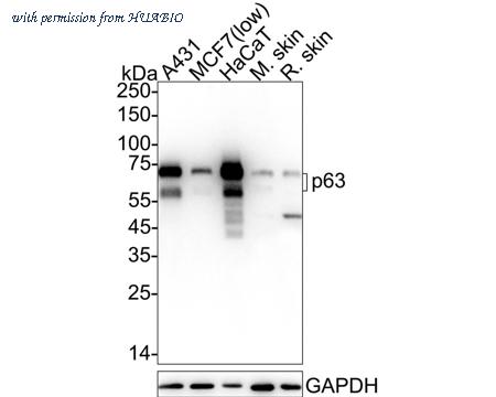 HUABIO HA750218 image 1