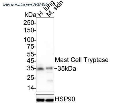 HUABIO HA750229 image 1